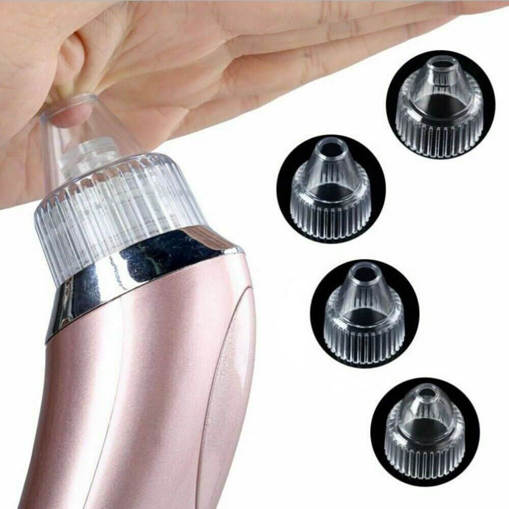 Unisex Electric Blackhead Pore Cleaner Acne Pimple Remover Strong Suction Tool - NeraVault