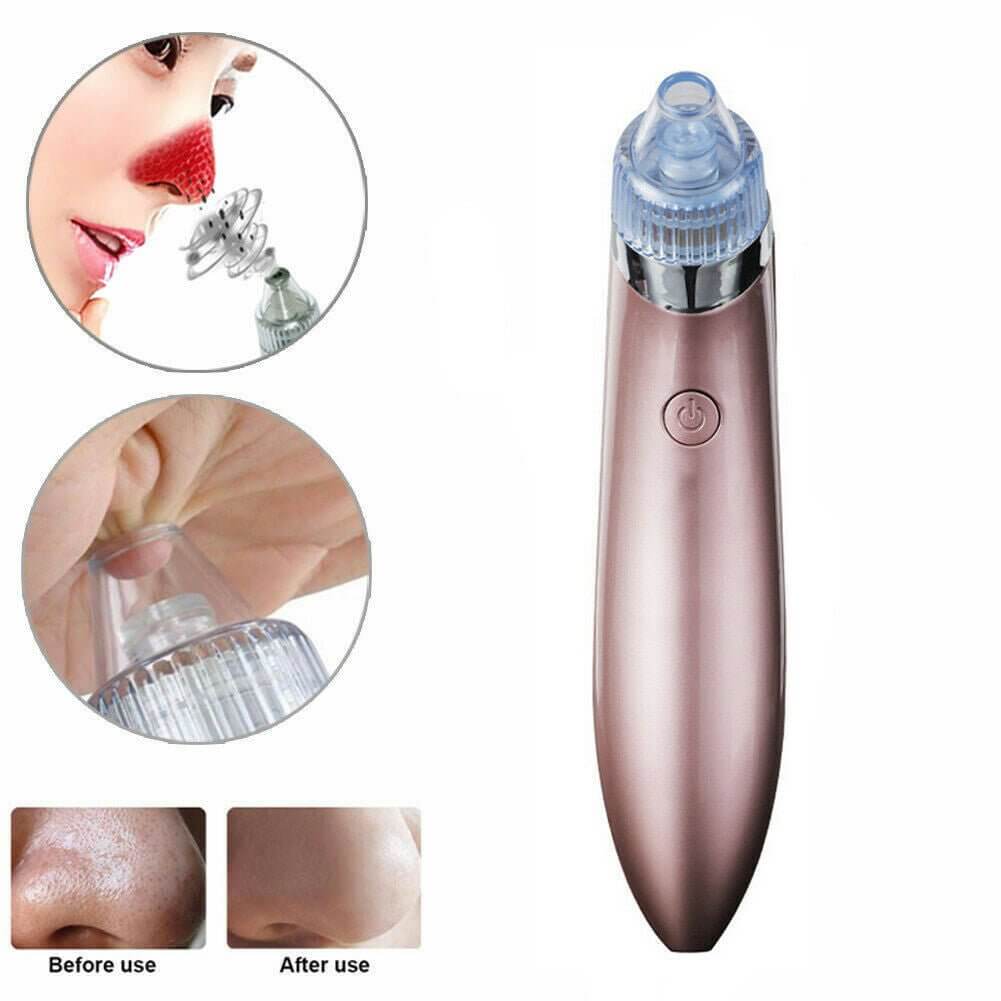 Unisex Electric Blackhead Pore Cleaner Acne Pimple Remover Strong Suction Tool - NeraVault