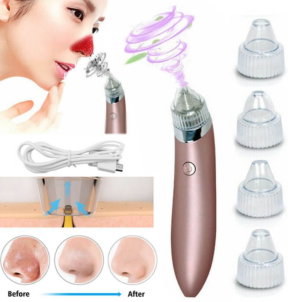 Unisex Electric Blackhead Pore Cleaner Acne Pimple Remover Strong Suction Tool - NeraVault
