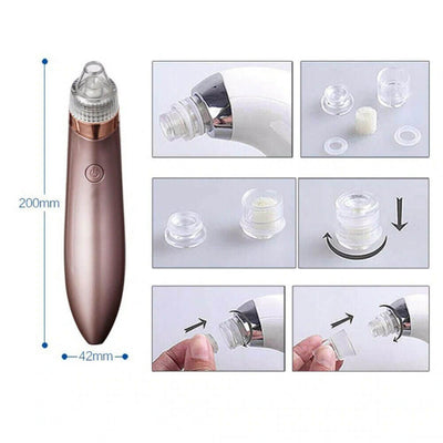Unisex Electric Blackhead Pore Cleaner Acne Pimple Remover Strong Suction Tool - NeraVault